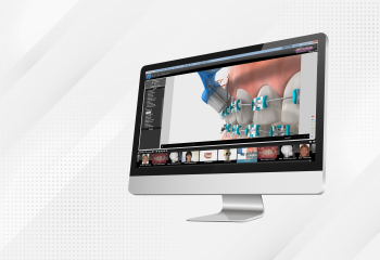 Using Treatment Findings With Edge Animations