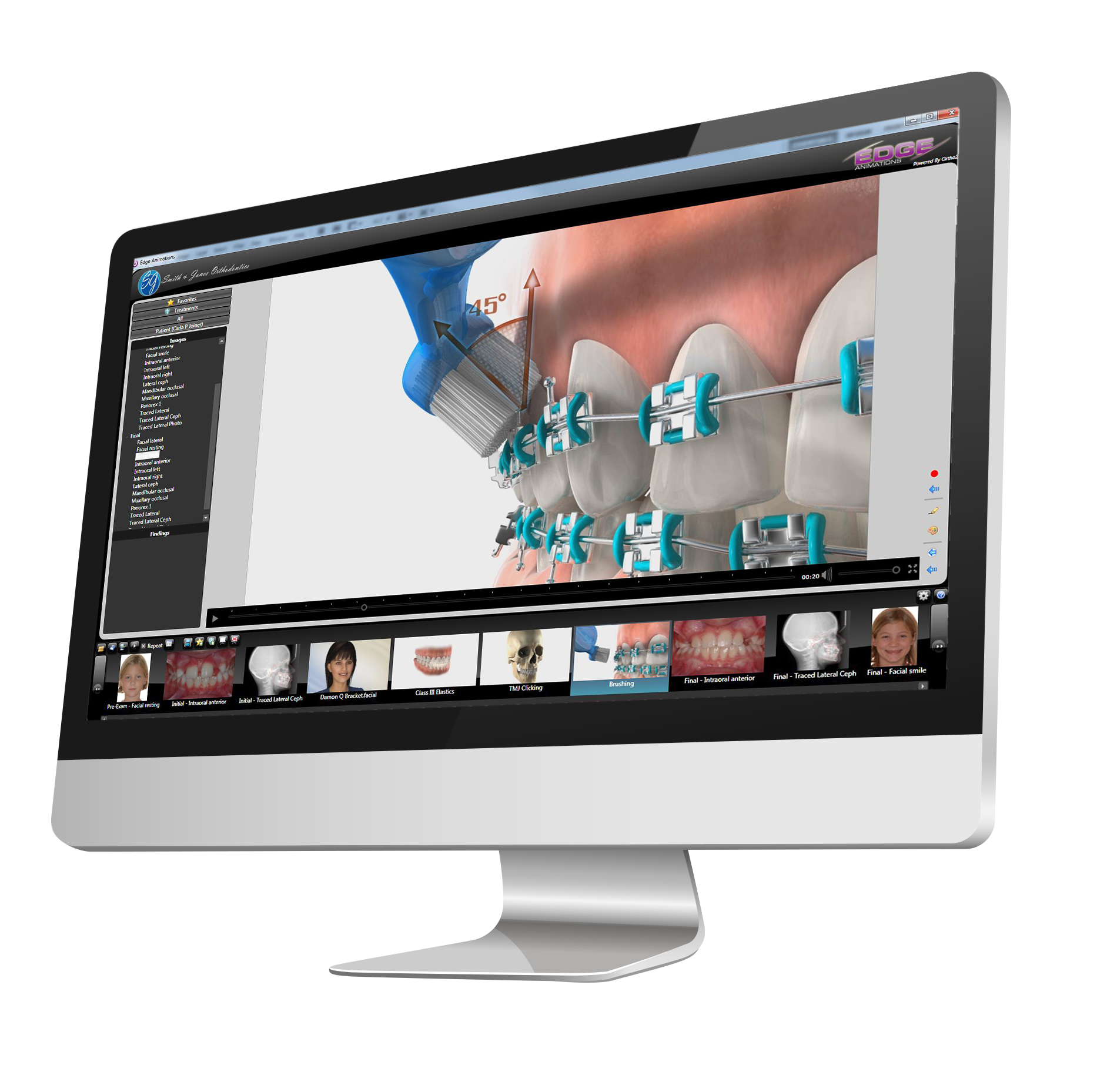 Edge Cloud Edge Animations